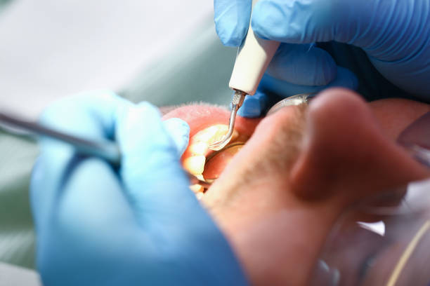 Best Emergency Tooth Extraction  in Senatobia, MS