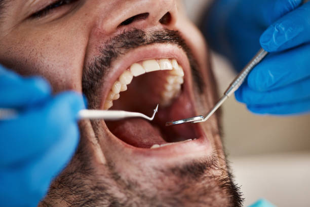 Best Dentist for Severe Toothache  in Senatobia, MS